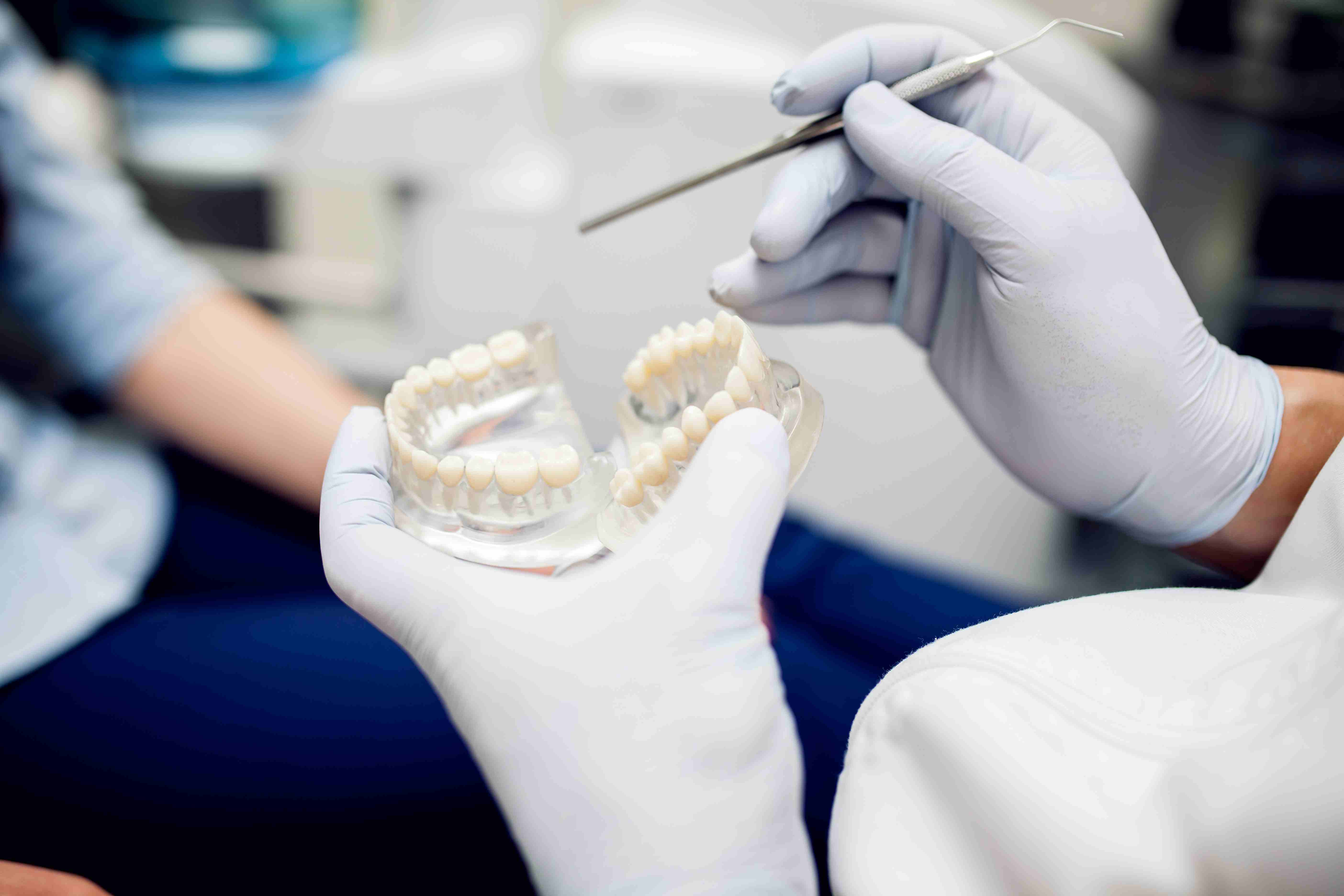 What are dental implants?