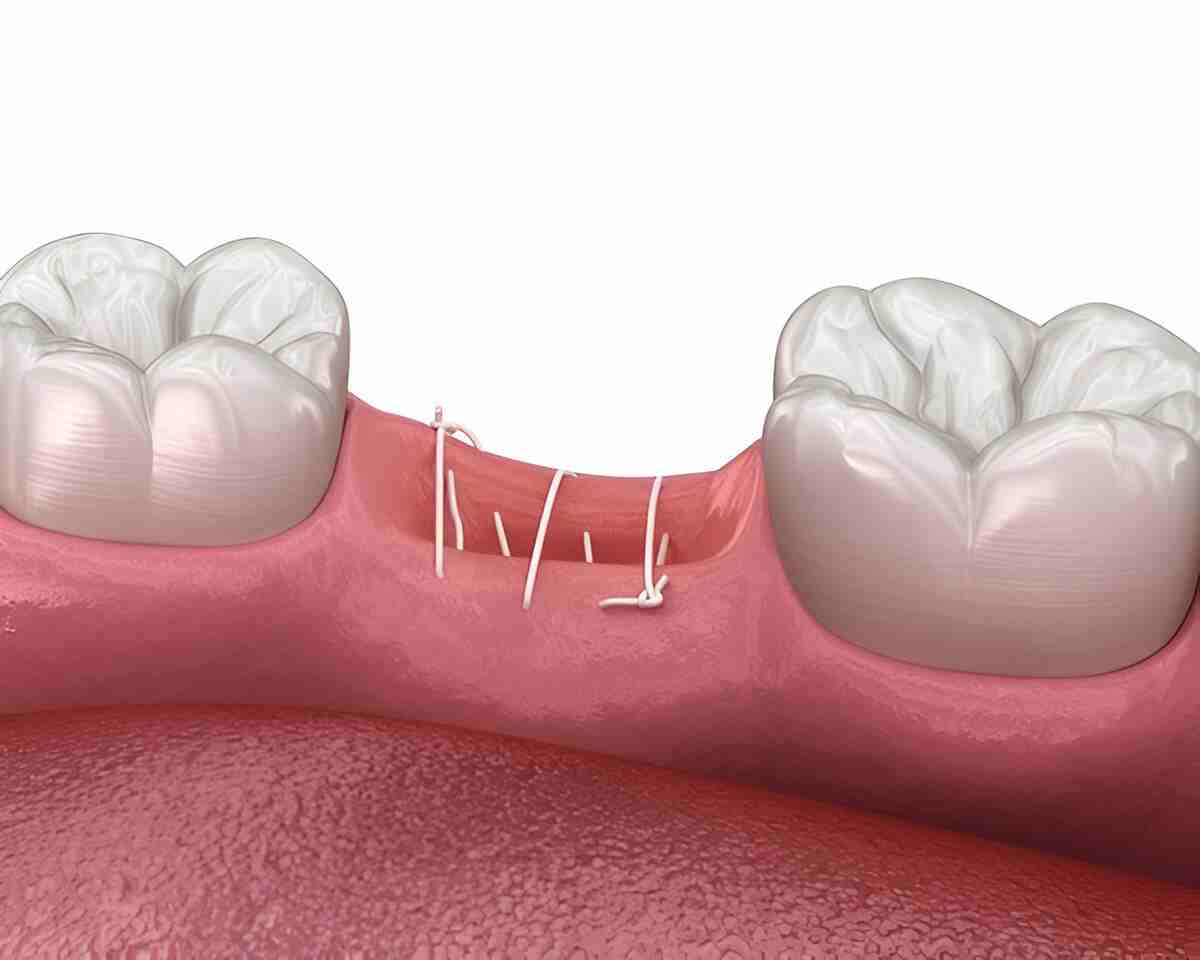 What is Filling & Restorative Dentistry