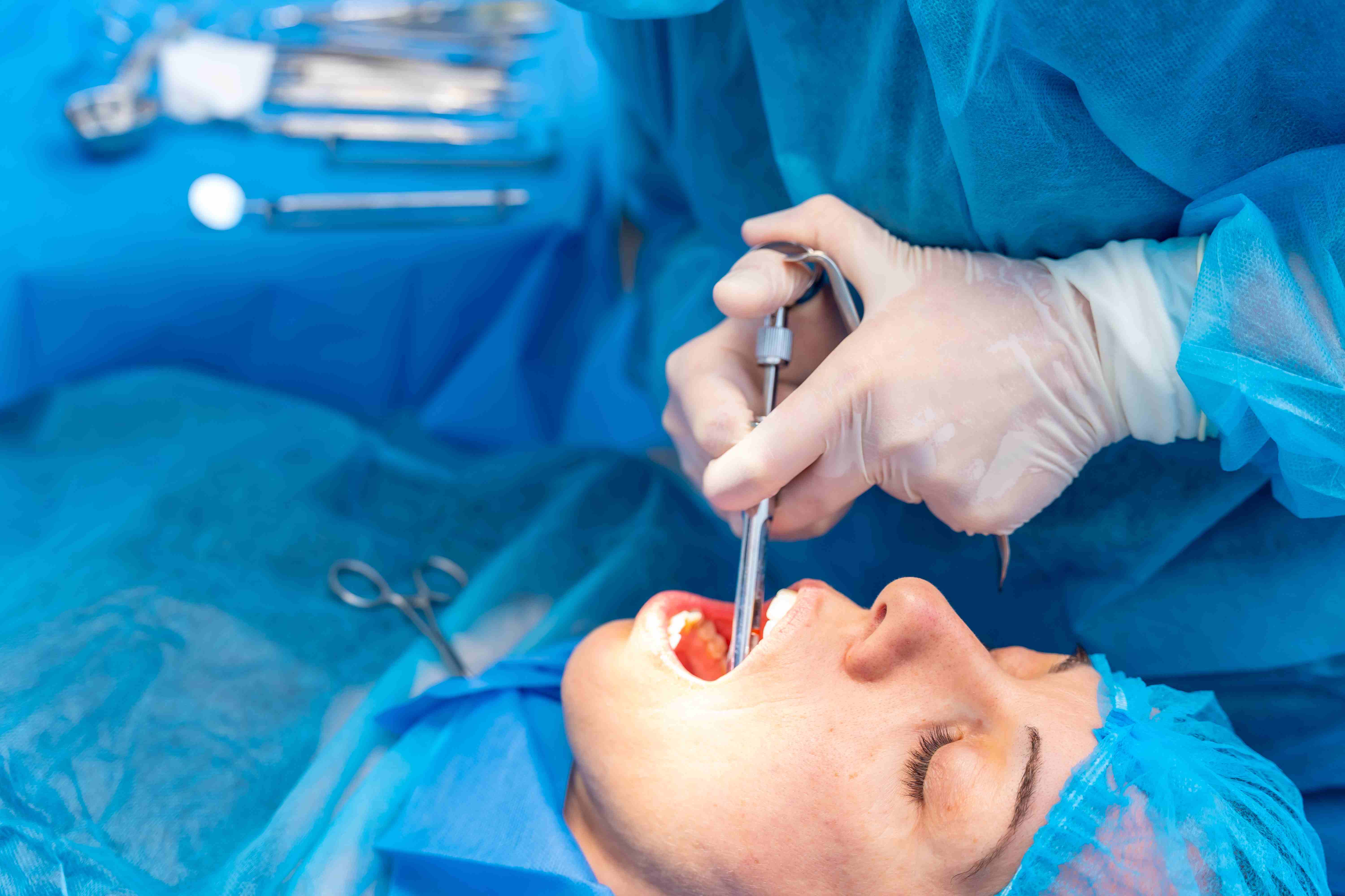 What is Minor Oral Surgery?