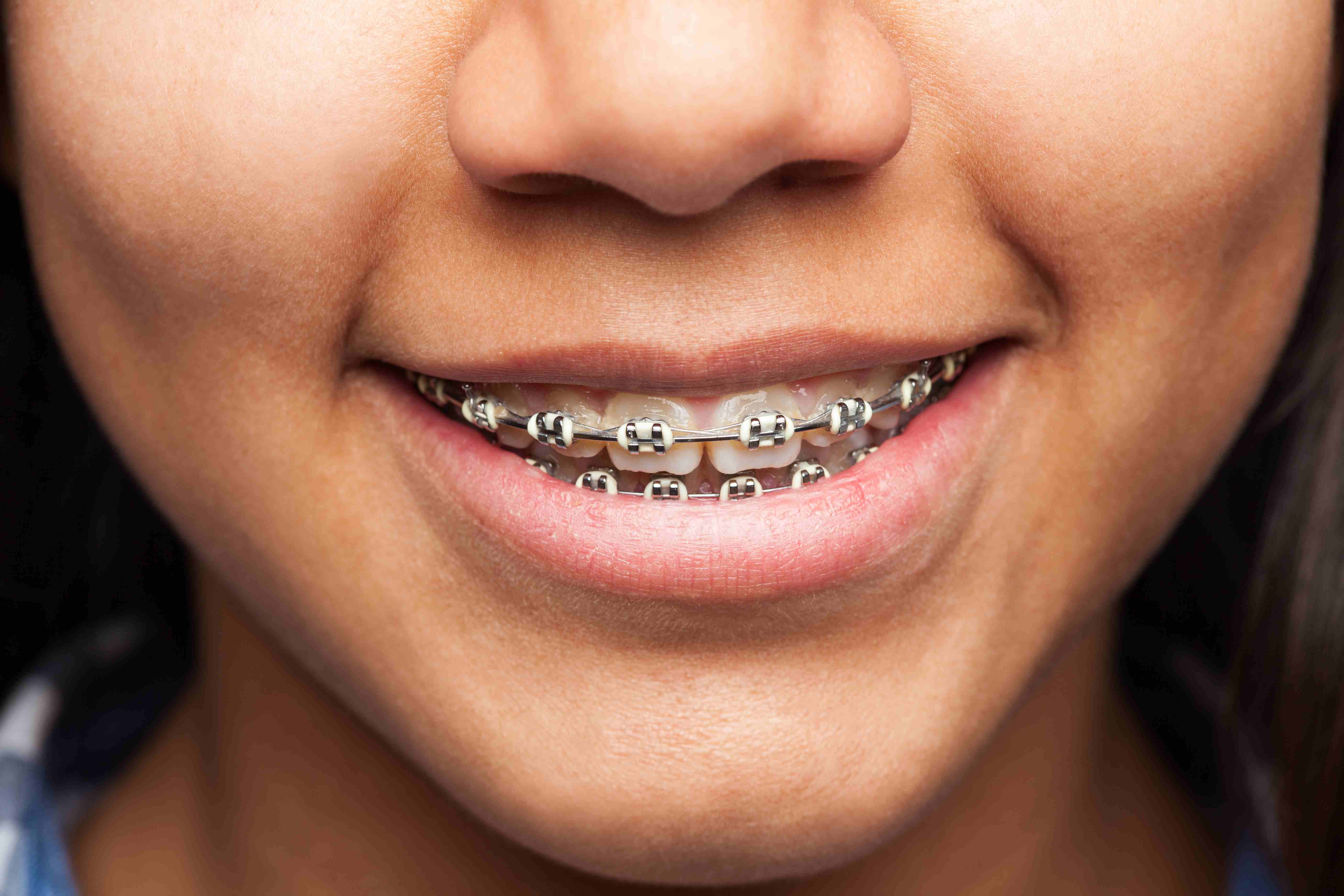 What is Orthodontics?