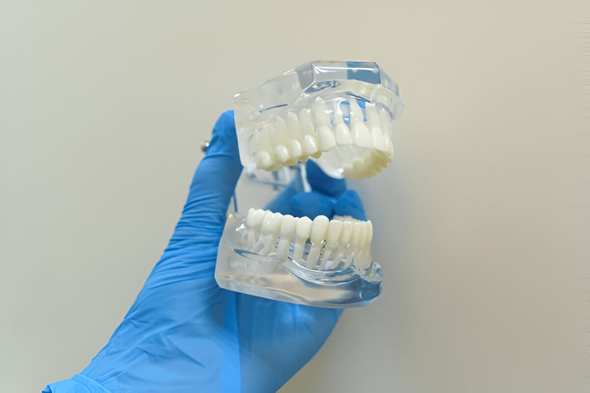 What is Prosthodontics?